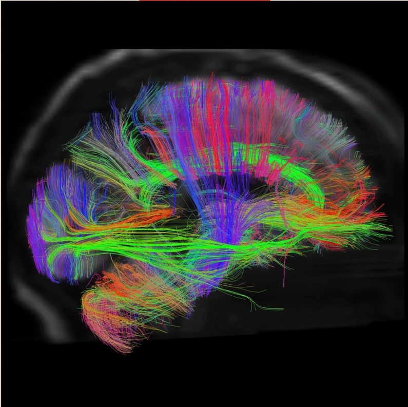 Investigadores estudiando el cerebro