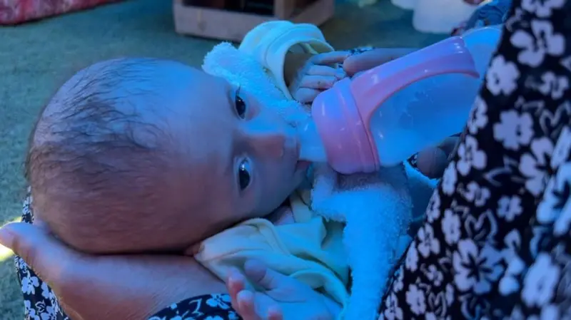 Siwar necesita una fórmula láctea especial debido a una reacción alérgica.